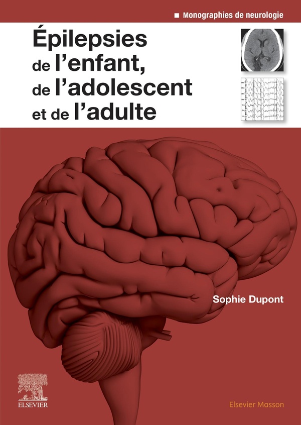  Epilepsies de l'enfant, de l'adolescent et de l'adulte 